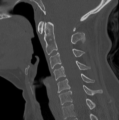 Un scanner rachis et colonne vertébrale dure quelques minutes seulement dans nos centres de Brest