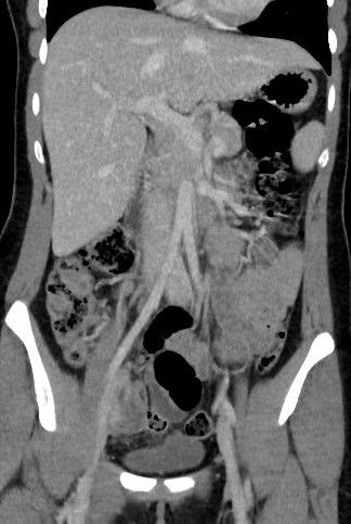 Un scanner de l'abdomen dure quelques minutes seulement dans nos centres de Brest