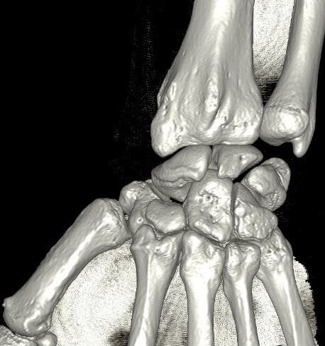 Un scanner des structures osseuses dure quelques minutes seulement dans nos centres de Brest